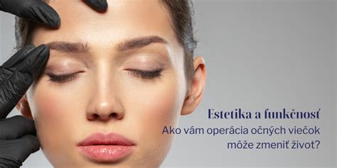 Estetika a funkčnosť kazetových podhľadov