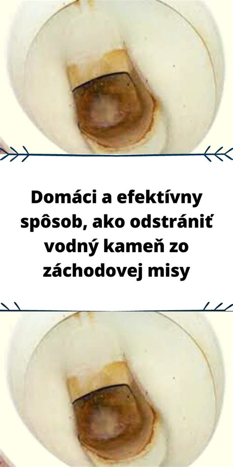 Vodný kameň v tepelnom výmenníku kotla