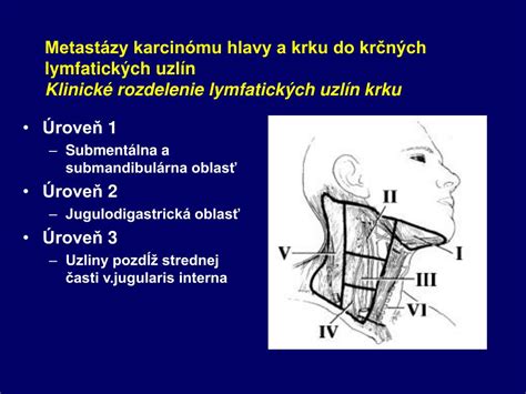 Mapa lymfatických uzlín v oblasti krku