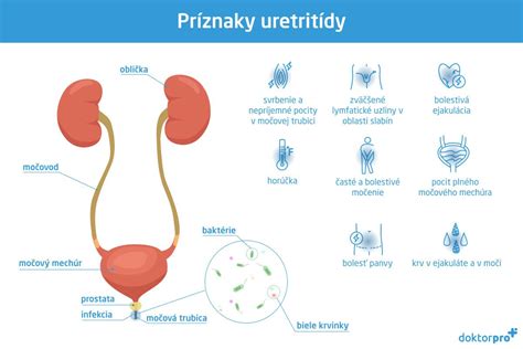 Príznaky uretritídy