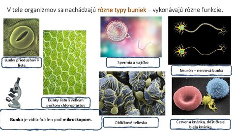 Rôzne typy buniek a ich bunkové steny