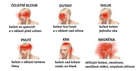 Mapa lokalizácie bolesti hlavy