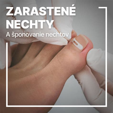 Schéma použitia frézky na zarastené nechty