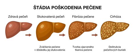 Schematické zobrazenie uhlovej vŕtacej hlavice a jej aplikácií