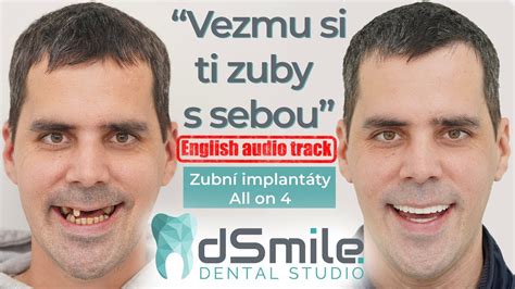 Schematické znázornenie pozitívneho a negatívneho uhla čela zuba