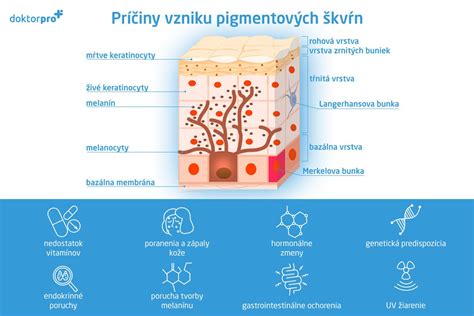 Príčiny vzniku plesní v domácnosti
