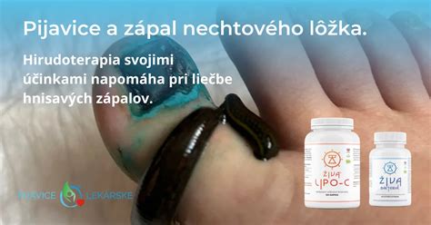Chirurgické ošetrenie zápalu nechtového lôžka