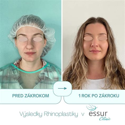 Rekonštrukcia tváre ženy zo Zlatého koňa