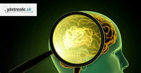 kombinácia obkladov a doplnkov