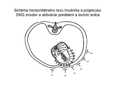 Schéma pokosového a úkosového rezu