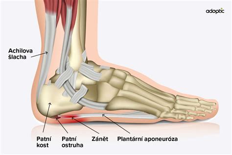 Schéma cviku na rozťahovanie plantárnej fascie