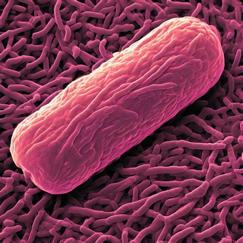 Vizualizácia narušenia bunkových stien E. coli ultrazvukom