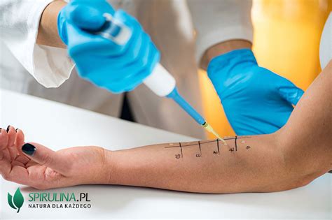 Laboratórne testy na alergie a infekcie
