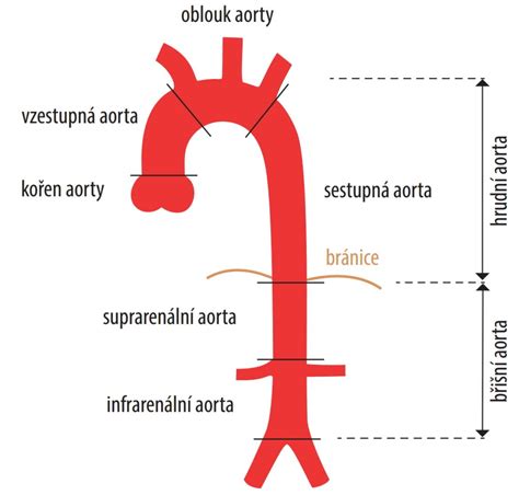 Oprava aneuryzmy aorty