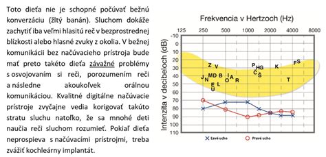 Príklady rôznych výšok spustenia svetelnej rampy