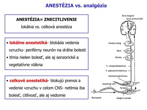 Diagram termoterapie (lokálna vs. celková, kontaktná vs. bezkontaktná)