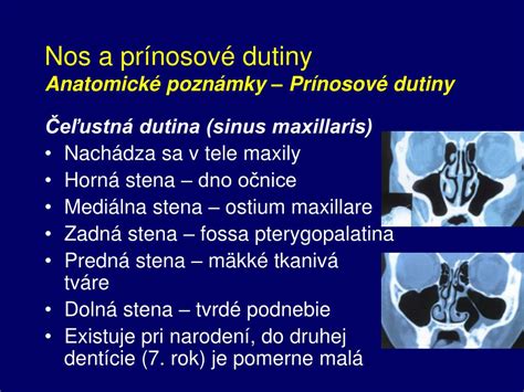 Schéma prínosových dutín v lebke
